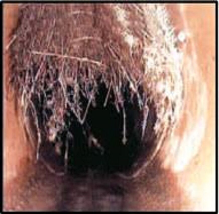 Tree roots blocking pipes