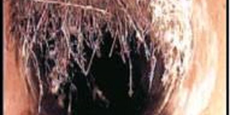 Tree roots blocking pipes