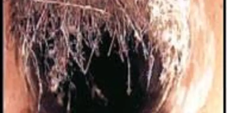 Tree roots blocking pipes